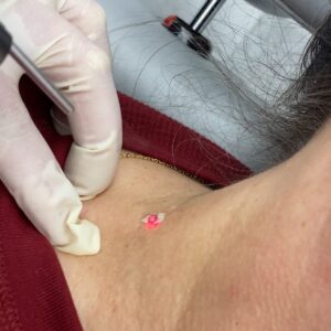 SinkorSwimAestheticsRemoval