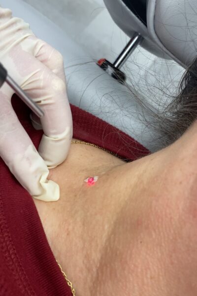 SinkorSwimAestheticsRemoval
